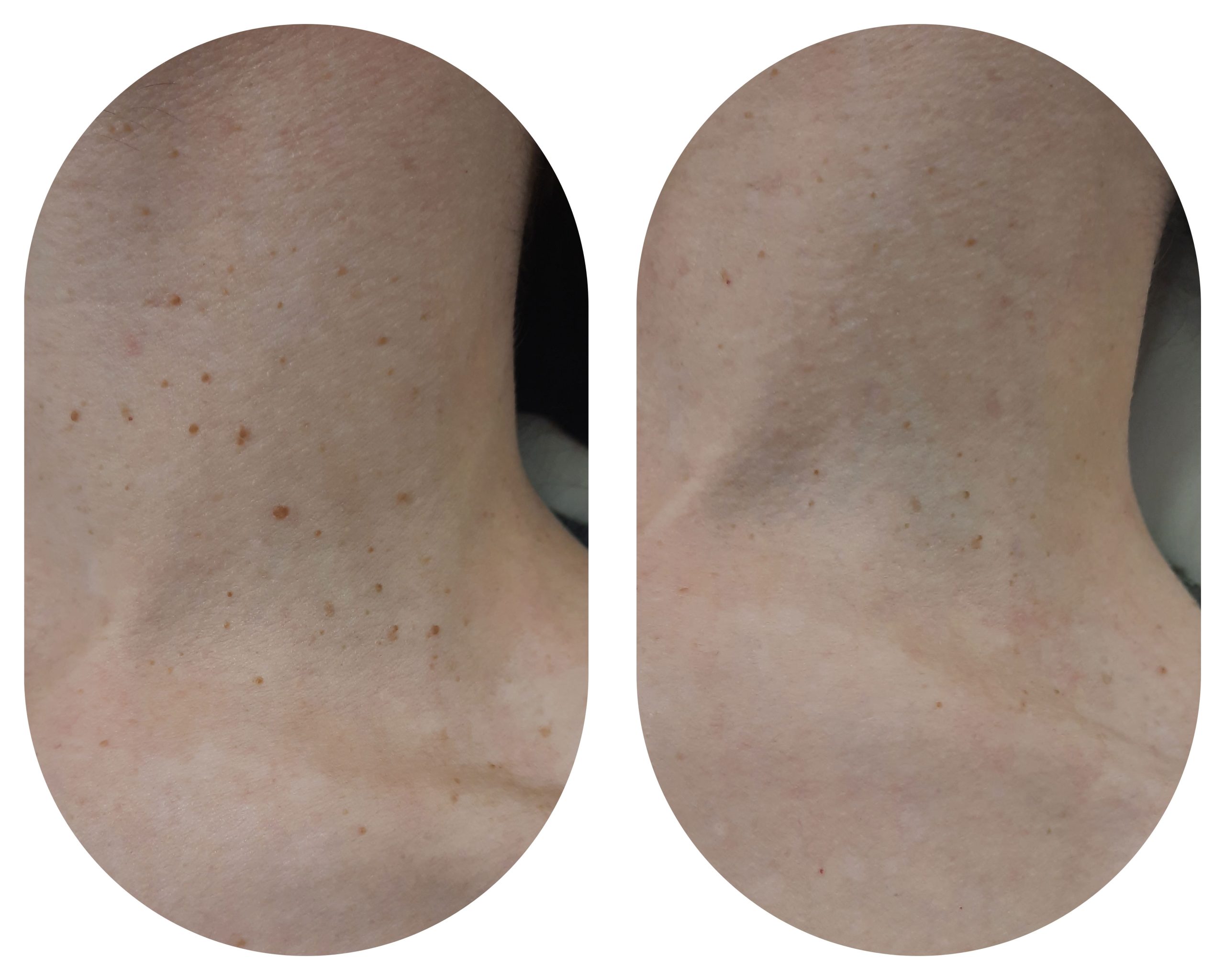 laser-azul-maite.style laser-azul-maite.style